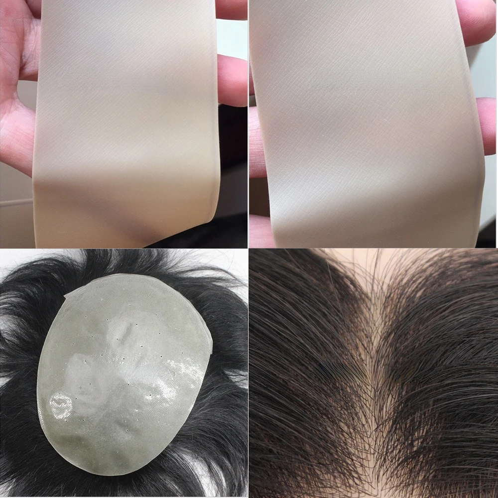 Understanding Hair Length and Density Limits in Thin Skin Hair Systems